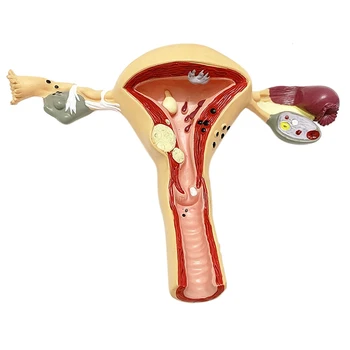 Inimese Emaka Ja Munasarjade Mudel, Reproduktiivse Organi Mudel, Naiste Suguelundite, Meditsiin Anatoomia Õpetamise